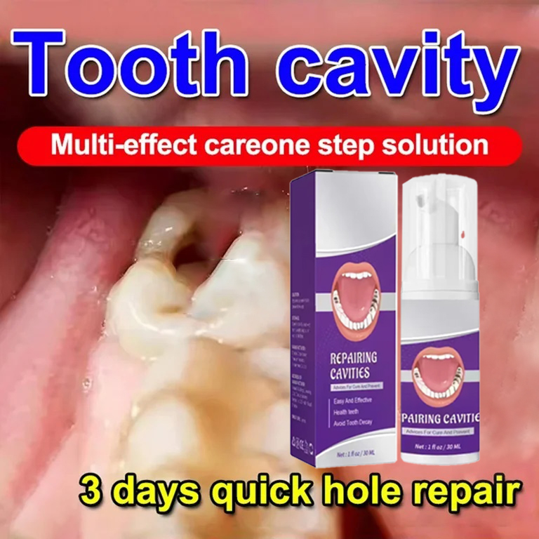 Teeth Whitening Cream - Zahnreinigung Zahnpasta Entfernt Zahnflecken Zahnaufhellung Zahnkariesreparatur