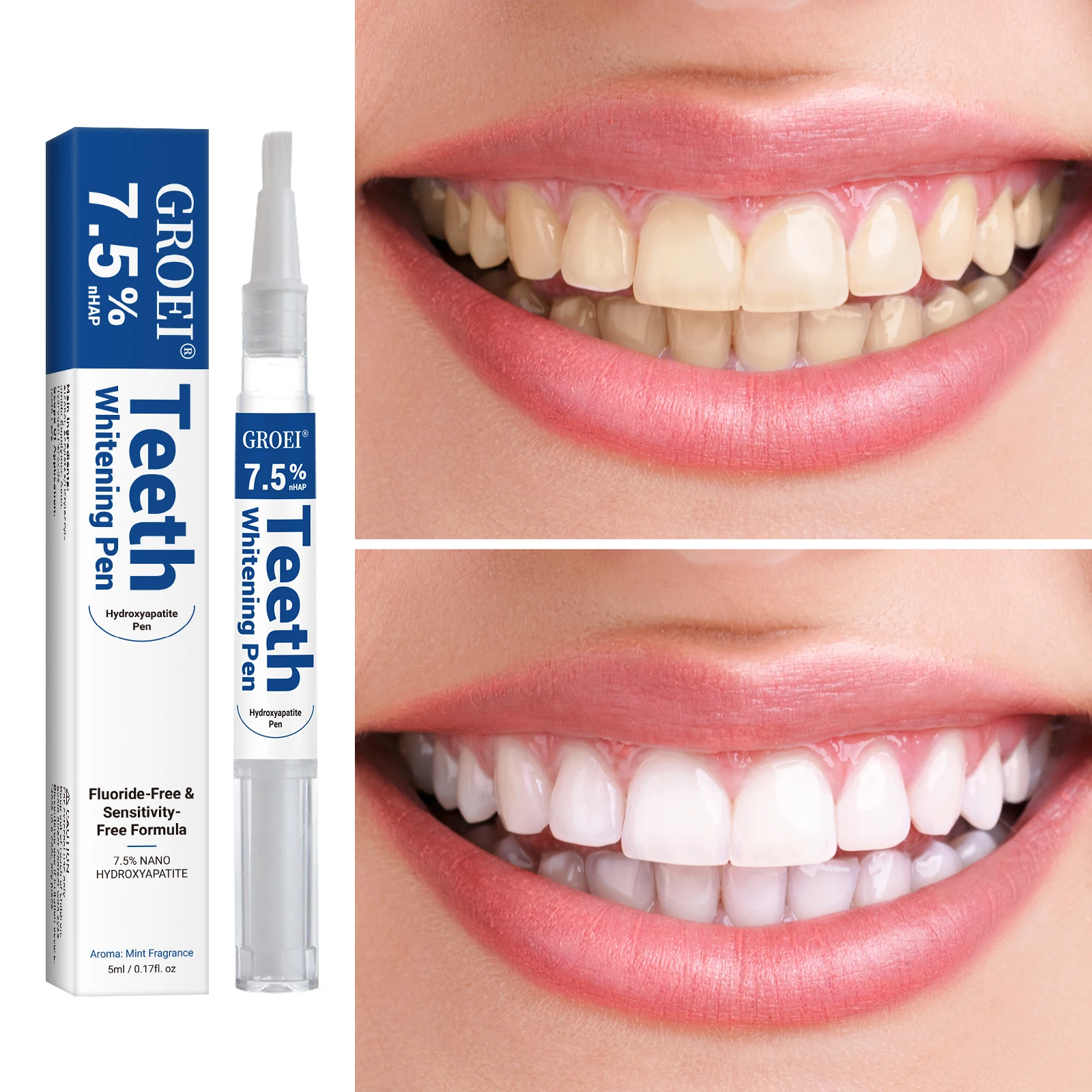 Hydroxyapatite Zahnaufhellungs – Teeth Whitening Near Me Bewertung und Preis
