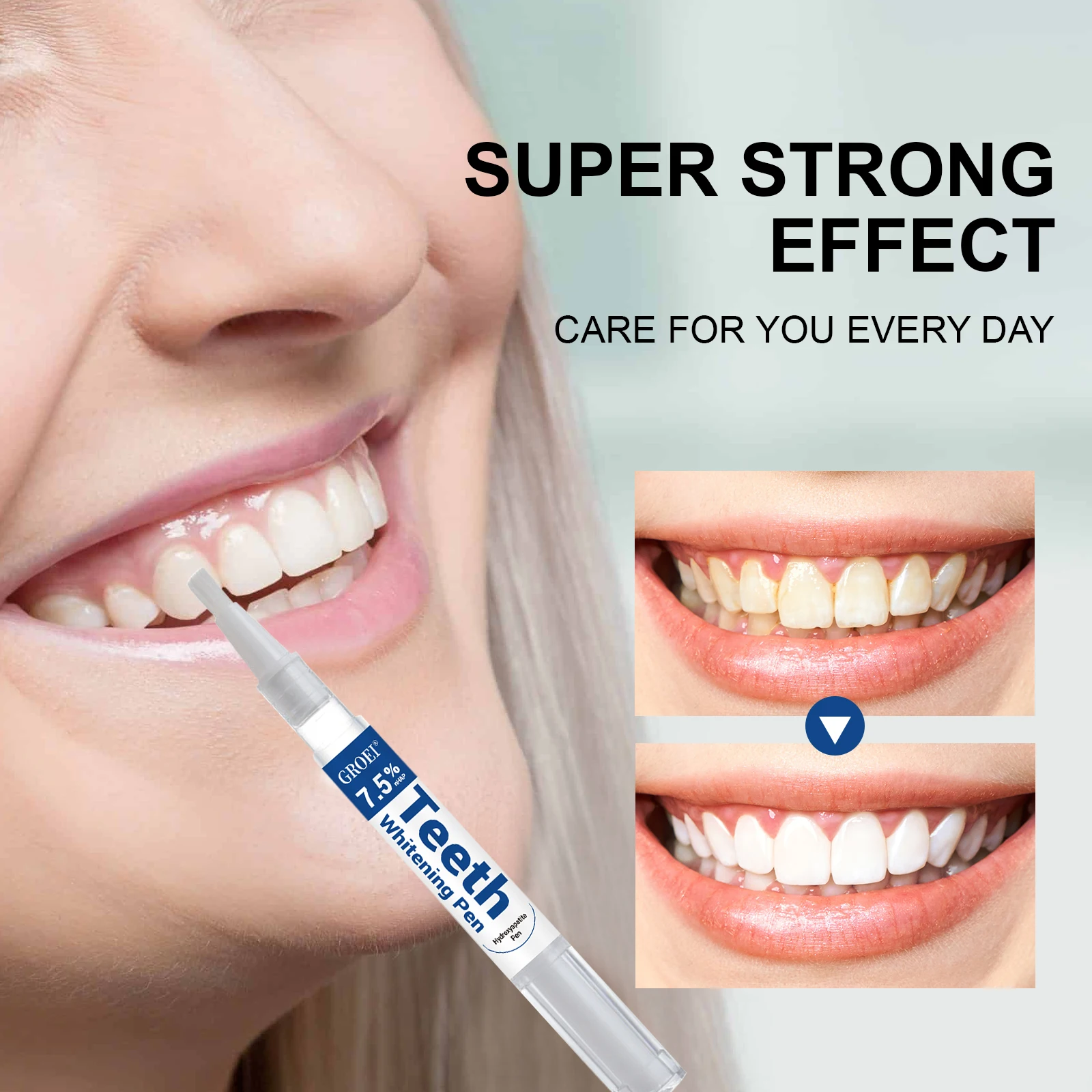 Hydroxyapatite Zahnaufhellungs – Teeth Whitening Near Me Bewertung und Preis