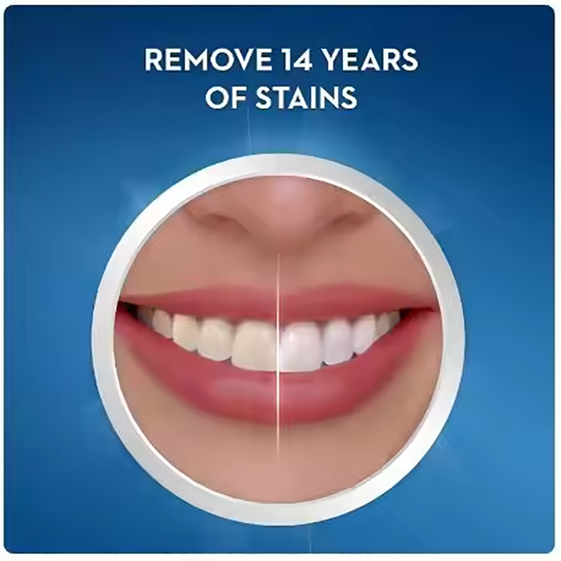 Crest Weiße Zahnaufhellungsstr – Teeth Whitening Effects Bewertung und Preis
