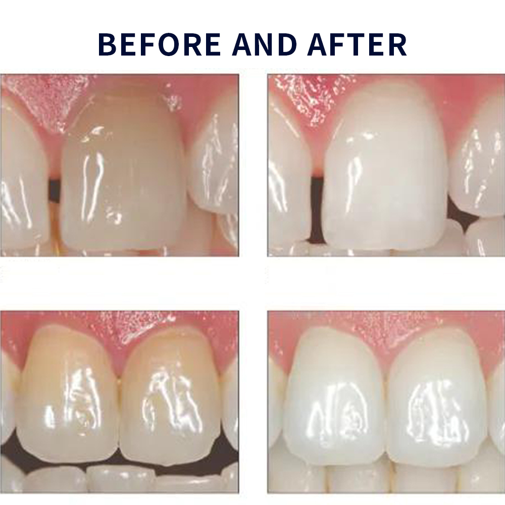 Opale scence White ning 1,2 pf – Teeth Whitening With Peroxide Bewertung und Preis