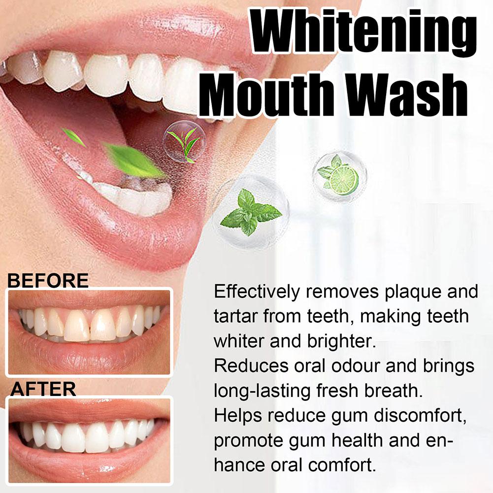 Kokos-Minze Mundpflegeöl Alkoh – Teeth Whitening Oil Pulling Bewertung und Preis