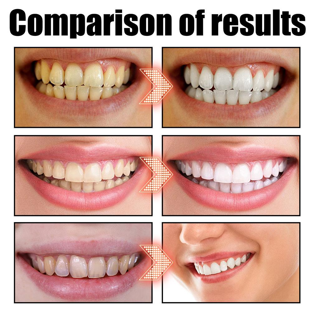 Kokos-Minze Mundpflegeöl Alkoh – Teeth Whitening Oil Pulling Bewertung und Preis