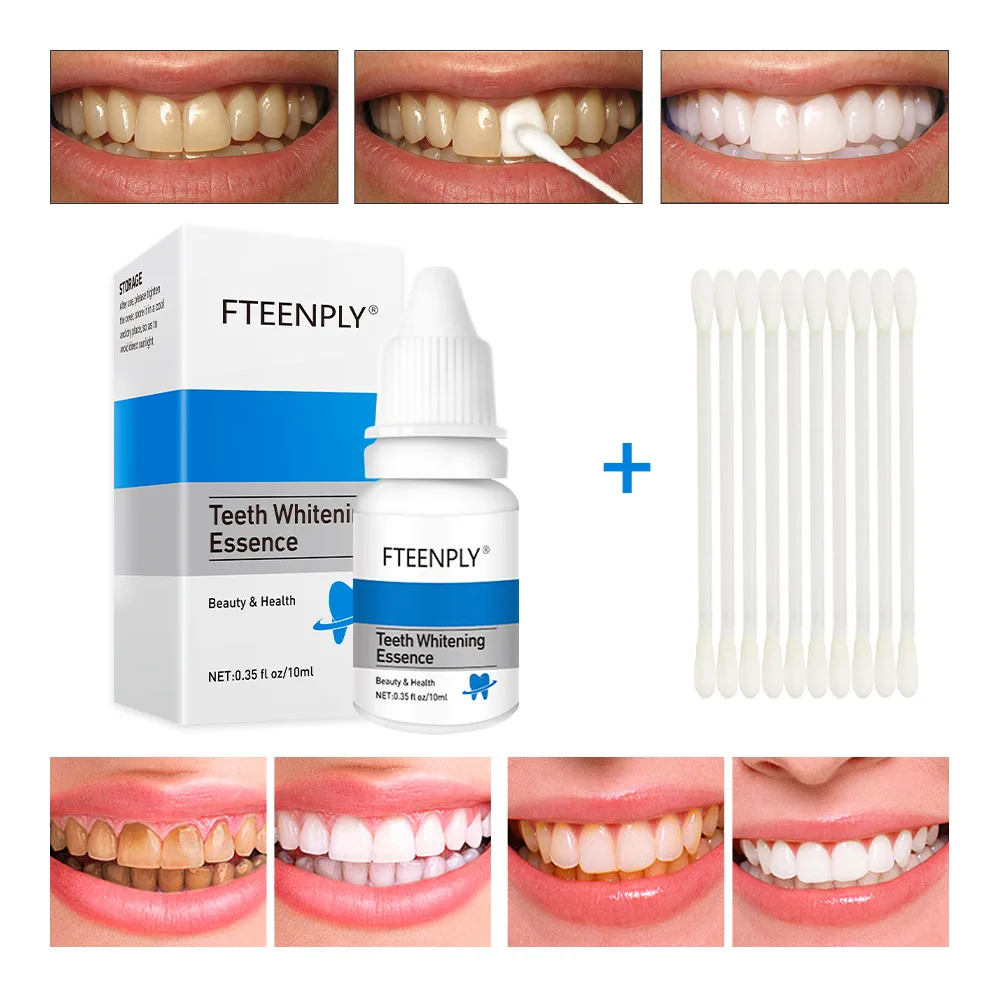 FTEENPLY Zahnaufhellung Essenz – Teeth Whitening Near Me Bewertung und Preis