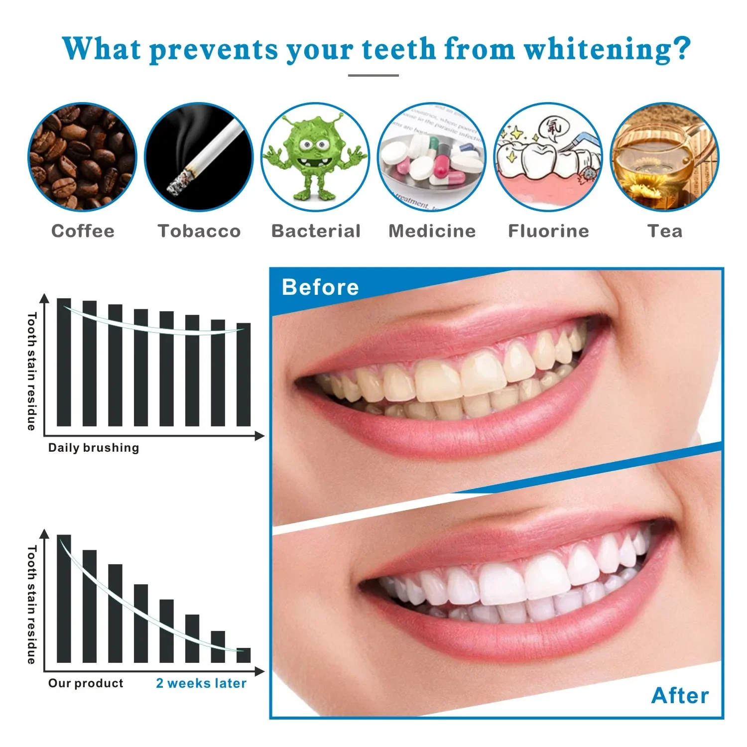 14/28 stücke 3D Zahnaufhellung – Teeth Whitening Effects Bewertung und Preis