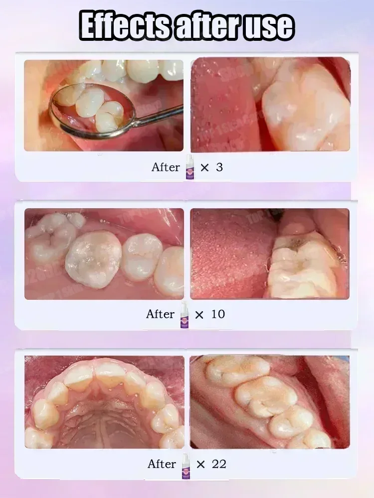Heiße Verkäufe Bestseller, wis – Teeth Whitening Cream Bewertung und Preis