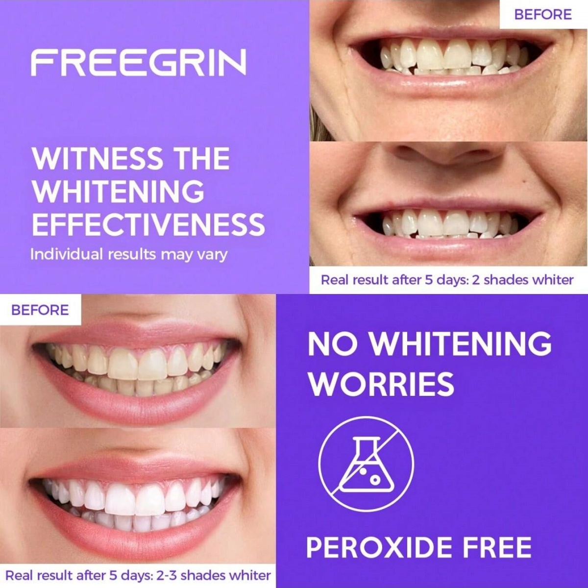 Deluxe Zahnaufhellungsaufklebe – Teeth Whitening With Peroxide Bewertung und Preis