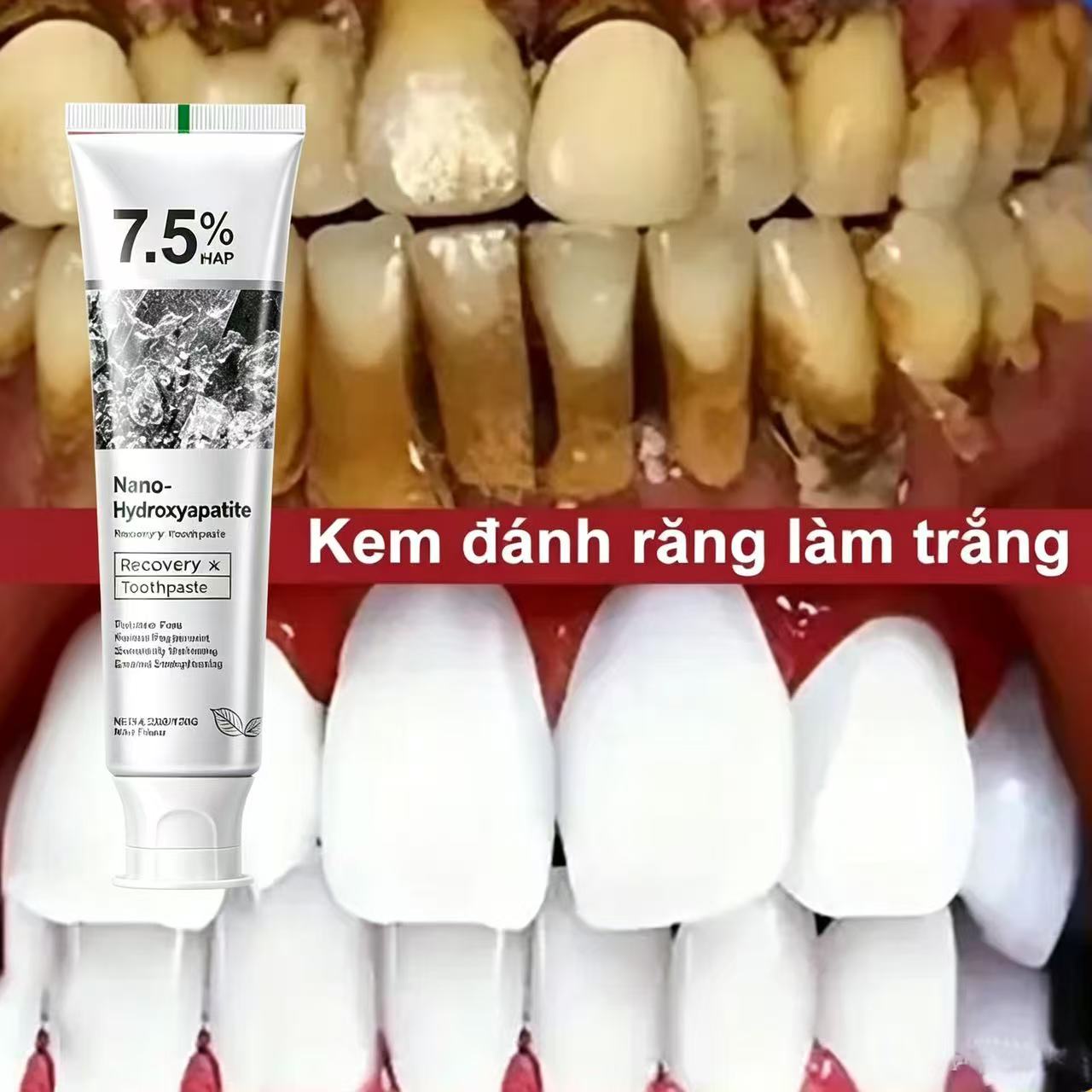 7,5% Hydroxyapatit Probiotisch – Teeth Whitening Cream Bewertung und Preis