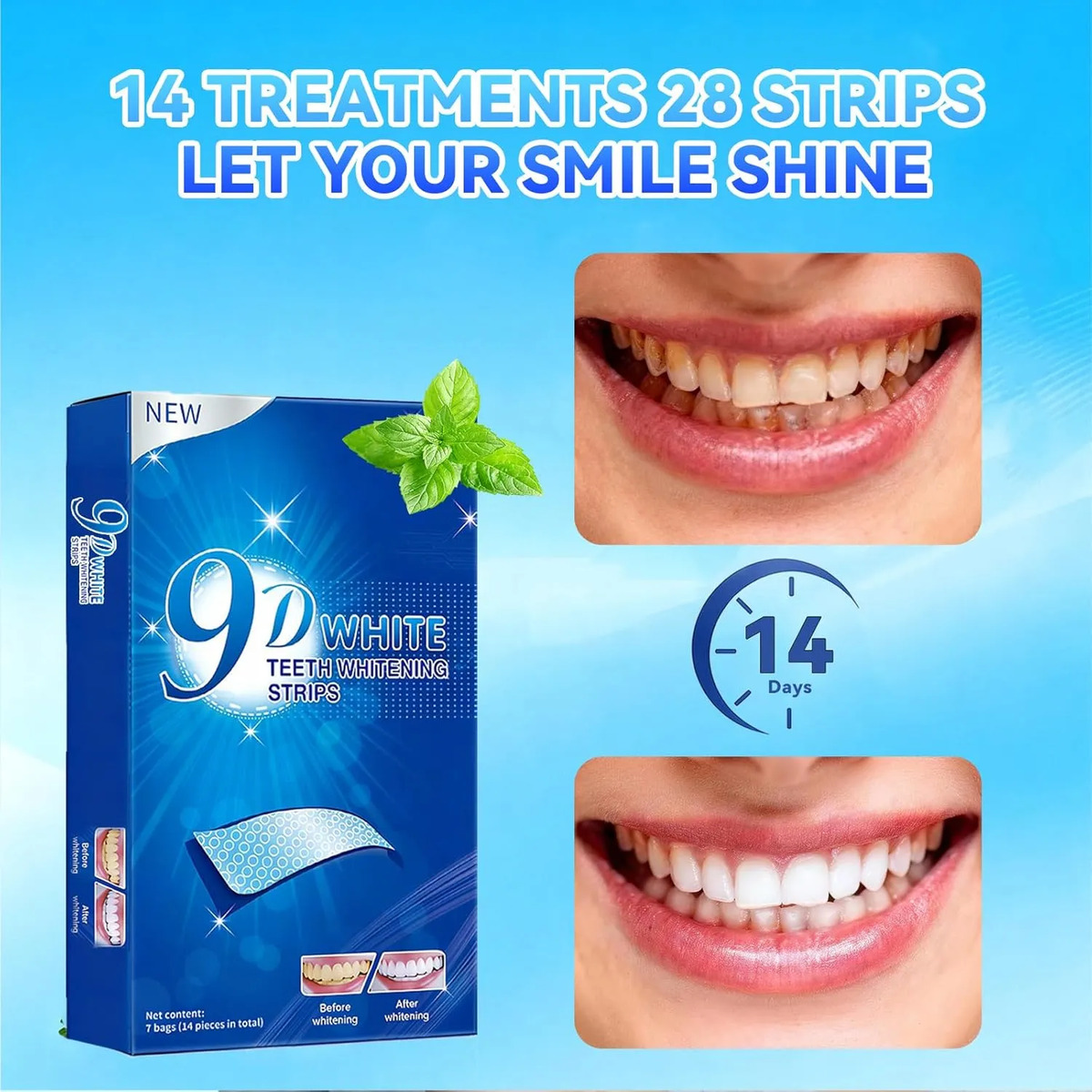 Zahnaufhellungsstreifen - 9D Z – Teeth Whitening Effects Bewertung und Preis